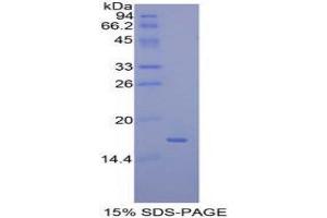 SDS-PAGE (SDS) image for Mucosae Associated Epithelia Chemokine (AA 17-130) protein (His tag) (ABIN1878133)