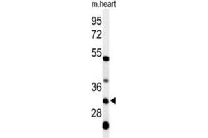 Western Blotting (WB) image for anti-Holocytochrome C Synthase (HCCS) antibody (ABIN3004361)