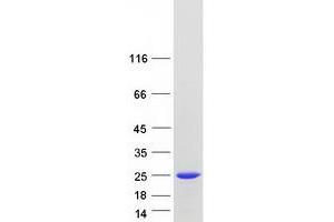 Validation with Western Blot