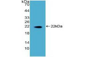 Detection of Recombinant DKC, Human using Polyclonal Antibody to Dyskerin (DKC) (DKC1 anticorps)