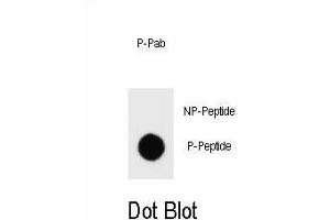 Dot blot analysis of Phospho-ERBB2- Antibody Phospho-specific Pab j on nitrocellulose membrane.