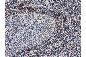 Image no. 3 for anti-Nonhomologous End-Joining Factor 1 (NHEJ1) antibody (ABIN1499729) (NHEJ1 anticorps)