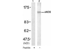 Image no. 1 for anti-Nitric Oxide Synthase 3 (Endothelial Cell) (NOS3) (Ser1177) antibody (ABIN319320) (ENOS anticorps  (Ser1177))