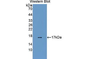 Western blot analysis of the recombinant protein. (EEA1 anticorps  (AA 1232-1348))