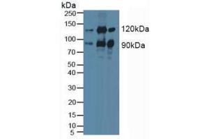 Western blot analysis of (1) Human HeLa cells, (2) Mouse Brain Tissue and (3) Porcine Brain Tissue. (PKC epsilon anticorps  (AA 403-672))