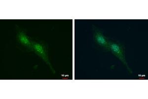 ICC/IF Image Androgen Receptor antibody [N1], N-term detects Androgen Receptor protein at cytoplasm and nucleus by immunofluorescent analysis.