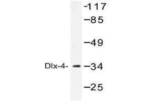 Western blot (WB) analysis of Dlx-4 antibody in extracts from COLO cells. (DLX4 anticorps)