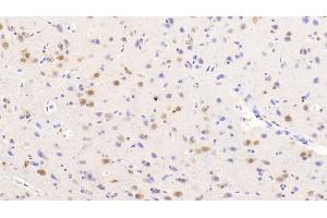 Detection of NOVA1 in Human Cerebrum Tissue using Polyclonal Antibody to Neuro Oncological Ventral Antigen 1 (NOVA1)
