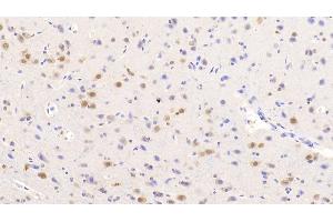 Detection of NOVA1 in Human Cerebrum Tissue using Polyclonal Antibody to Neuro Oncological Ventral Antigen 1 (NOVA1) (NOVA1 anticorps  (AA 295-510))