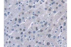Detection of AHNAK in Human Liver Tissue using Polyclonal Antibody to Desmoyokin (AHNAK)