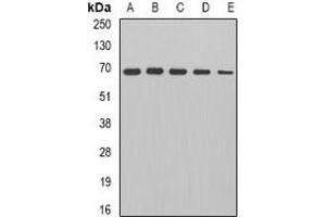 Western blot analysis of PDC-E2 expression in HepG2 (A), Jurkat (B), mouse heart (C), rat brain (D), rat kidney (E) whole cell lysates. (DLAT anticorps)
