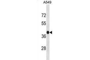 Western Blotting (WB) image for anti-G Protein-Coupled Receptor 77 (GPR77) antibody (ABIN3001276)