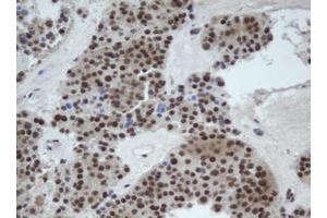 Image no. 2 for anti-Cullin 4B (CUL4B) (AA 1-300) antibody (ABIN1490724)