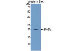 Western blot analysis of the recombinant protein. (CFP anticorps  (AA 315-469))