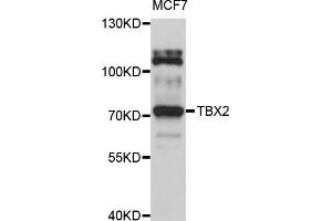 Western blot analysis of extracts of MCF-7 cells, using TBX2 antibody (ABIN5999016) at 1/1000 dilution. (TBX2 anticorps)