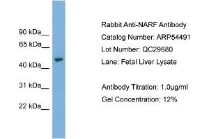 WB Suggested Anti-NARF  Antibody Titration: 0. (NARF anticorps  (Middle Region))