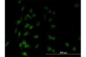 Immunofluorescence of monoclonal antibody to TAF7 on HeLa cell.