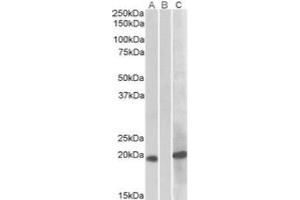 HEK293 lysate (10 µg protein in RIPA buffer) overexpressing Human HOXA1 with C-terminal MYC tag probed with AP21275PU-N (1 ug/ml) in Lane A and probed with anti-MYC Tag (1/1000) in lane C. (HOXA1 anticorps)
