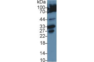 Western Blot; Sample: Human Hela cell lysate; Primary Ab: 2µg/ml Rabbit Anti-Rat CASP3 Antibody Second Ab: 0. (Caspase 3 anticorps  (AA 29-175))