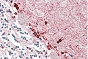 AP20186PU-N ALDH9A1 antibody staining of paraffin embedded Human Cerebellum at 3. (ALDH9A1 anticorps  (Internal Region))