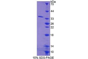 SDS-PAGE analysis of Human CES1 Protein.