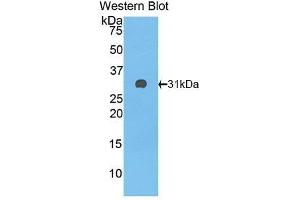 Western Blotting (WB) image for anti-Complement Factor H (CFH) (AA 915-1156) antibody (ABIN3208199) (Complement Factor H anticorps  (AA 915-1156))