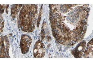ABIN6273377 at 1/100 staining Human prostate tissue by IHC-P. (ATP12A anticorps  (N-Term))