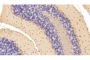 Detection of NME1 in Mouse Cerebellum Tissue using Polyclonal Antibody to Non Metastatic Cells 1, Protein NM23A Expressed In (NME1) (NME1 anticorps  (AA 6-147))