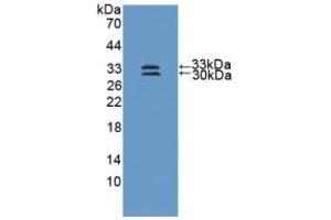 Western blot analysis of recombinant Human SOD3. (SOD3 anticorps  (AA 19-240))