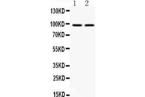 Anti- AHR Picoband antibody, Western blotting All lanes: Anti AHR  at 0. (Aryl Hydrocarbon Receptor anticorps  (Middle Region))