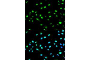 Immunofluorescence analysis of MCF7 cell using LETMD1 antibody. (LETMD1 anticorps  (AA 161-360))