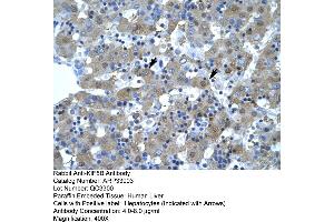 Human Liver (KIF5B anticorps  (N-Term))