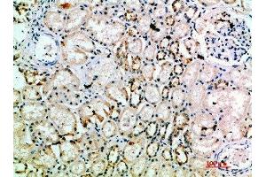 Immunohistochemical analysis of paraffin-embedded human-kidney, antibody was diluted at 1:200 (L1CAM anticorps  (AA 151-200))