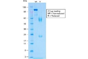 SDS-PAGE Analysis of Purified MART-1 Rabbit Recombinant Monoclonal Antibody (MLANA/1409R). (Recombinant MLANA anticorps)