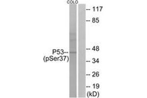 Western blot analysis of extracts from COLO cells, using p53 (Phospho-Ser37) Antibody. (p53 anticorps  (pSer37))
