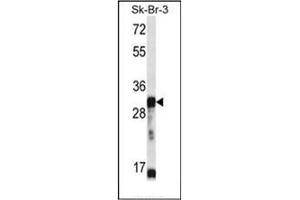 Western blot analysis of OR5D13 Antibody (Center) in SK-BR-3 cell line lysates (35ug/lane). (OR5D13 anticorps  (Middle Region))