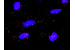 anti-Phospholipase C gamma 2 (PLCG2) (AA 1-1265) antibody
