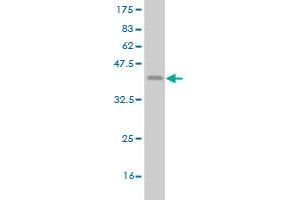 Western Blot detection against Immunogen (37. (ETV1 anticorps  (AA 148-257))