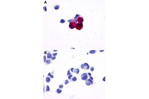 Immunocytochemistry (ICC) staining of HEK293 human embryonic kidney cells transfected (A) or untransfected (B) with PRLHR. (PRLHR anticorps  (2nd Extracellular Domain))