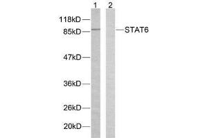 Western blot analysis of extracts from HeLa cells using STAT6 (Ab-645) antibody (E021051). (STAT6 anticorps)