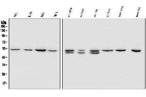 Western blot analysis of SOX11 using anti-SOX11 antibody (ABIN7599320).