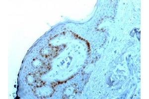 anti-Nucleolar / Nucleoli antibody