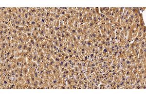 Detection of GHR in Mouse Liver Tissue using Polyclonal Antibody to Growth Hormone Receptor (GHR) (Growth Hormone Receptor anticorps  (AA 36-266))