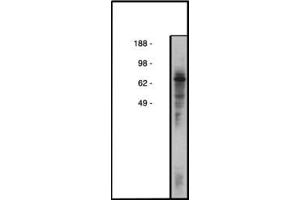 Image no. 1 for anti-Collagen, Type IV, alpha 3 (Goodpasture Antigen) Binding Protein (COL4A3BP) antibody (ABIN793680) (COL4A3BP anticorps)