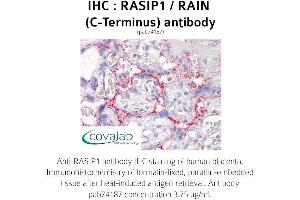Image no. 1 for anti-Ras Interacting Protein 1 (RASIP1) (C-Term) antibody (ABIN1738746) (RASIP1 anticorps  (C-Term))