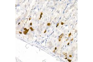 Immunohistochemistry of paraffin-embedded mouse stomach using DDC Rabbit pAb (ABIN1679510, ABIN3018150, ABIN3018151 and ABIN6220384) at dilution of 1:25 (40x lens).