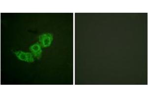 Immunofluorescence analysis of HuvEc cells, using EGFR (Phospho-Thr678) Antibody. (EGFR anticorps  (pThr678))