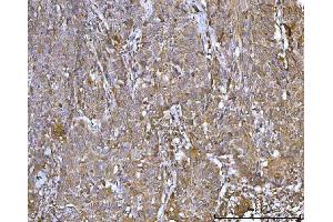 IHC analysis of CCDC115 using anti-CCDC115 antibody (ABIN7599042). (CCDC115 anticorps  (AA 1-180))