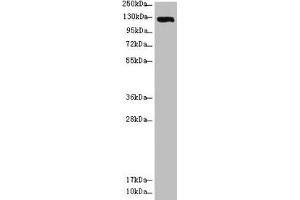 Western blot All lanes: USP28 antibody at 3. (USP28 anticorps  (AA 430-580))
