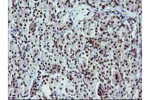 Image no. 2 for anti-Tumor Protein P73 (TP73) (AA 167-409) antibody (ABIN1491005)